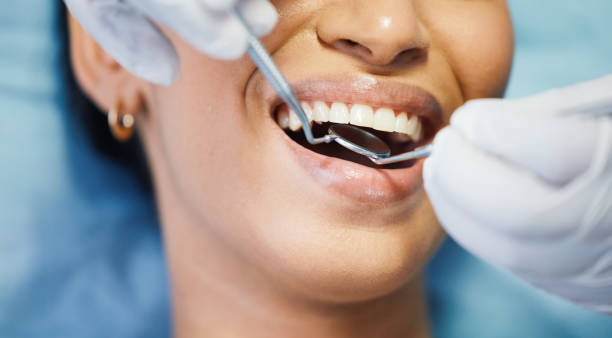 Best Knocked-Out Tooth Emergency  in Glendale, CO